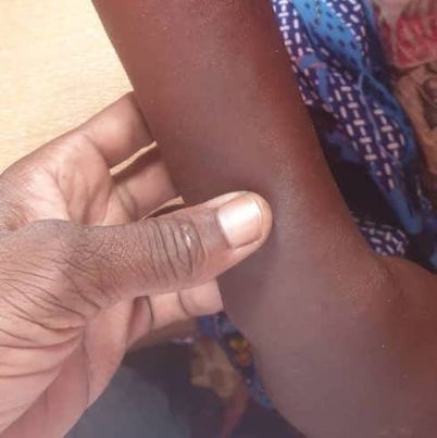 Tchad : une fille torturée après le vol d’une tasse de graines de Néré