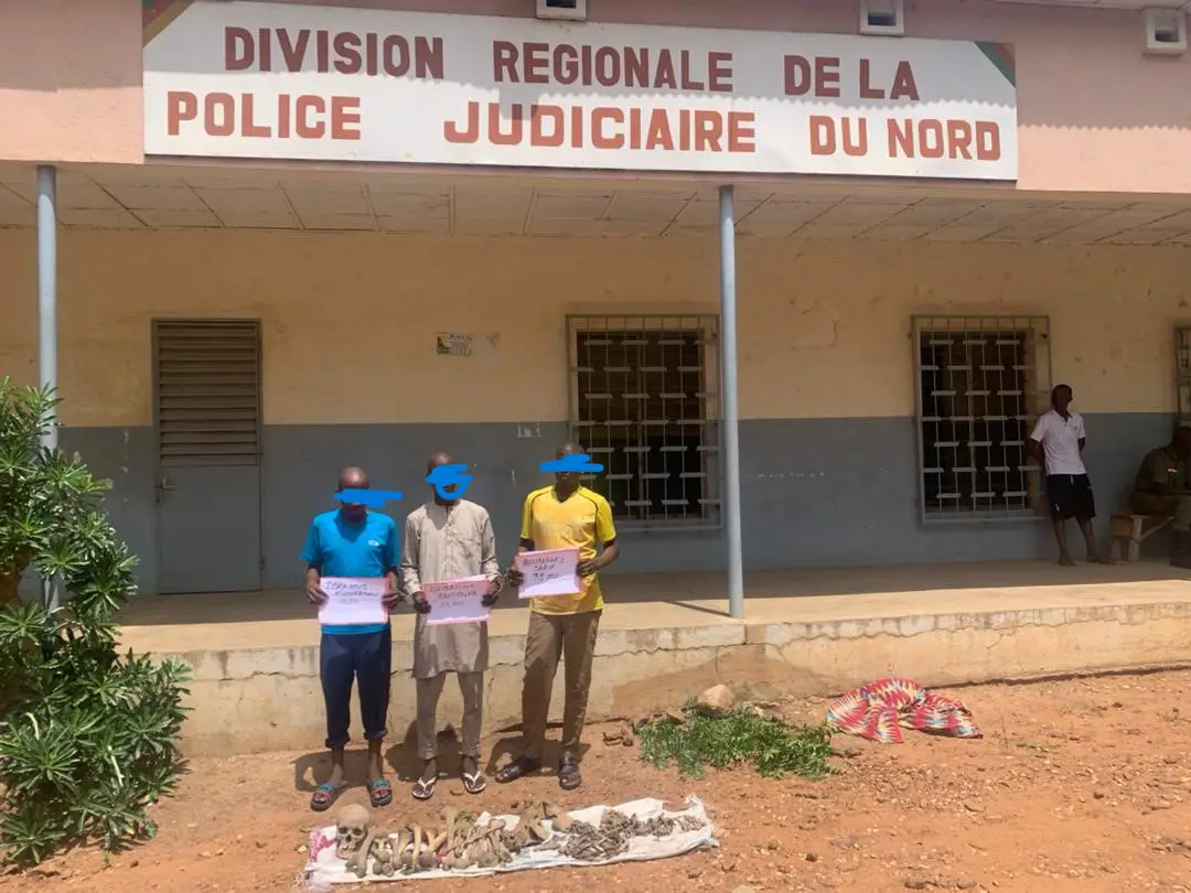 Cameroun - Trafic d'ossements humains : Trois suspects arrêtés dans le Nord